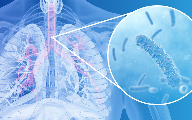 结核/非结核快速检测